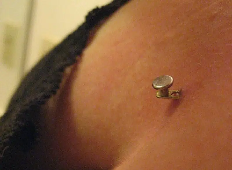 Comment se fait un implant piercing